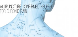 acupuncture for pain relief