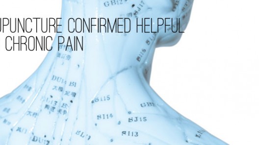 acupuncture for pain relief